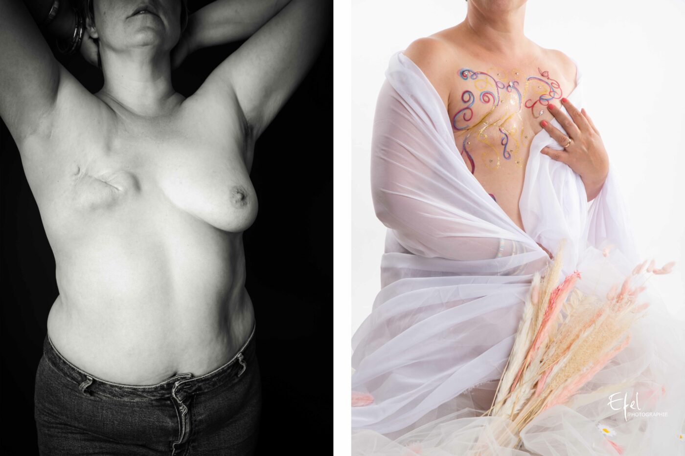 Exposition-photo-de-nos-cicatrices-nous-avons-fait-des-ailes-mastectomie