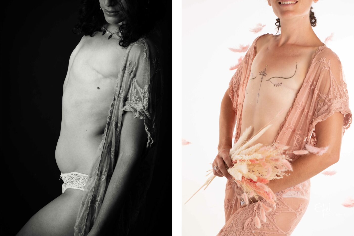 Exposition-photo-de-nos-cicatrices-nous-avons-fait-des-ailes-mastectomie